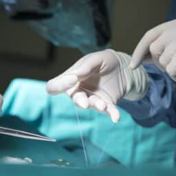 Close up of doctor performing surgery